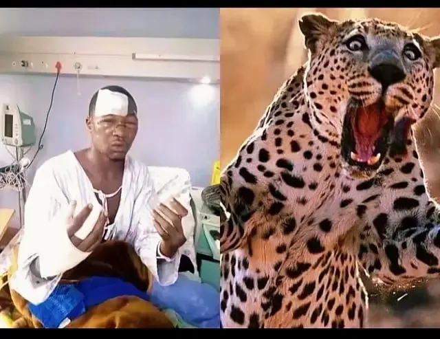 Bro survived the fight but the leopard didn’t get the chance, it was k