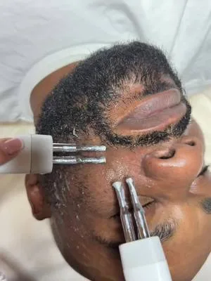 Client turned to microcurrent therapy, a treatment also beneficial for