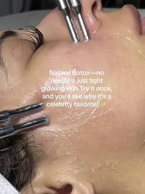 Natural Botox—no needles, just glow! Try it once, and you’ll see why i