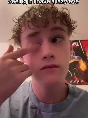 I don’t know what happened #fyp #foryou #tiktok #lazyeye #goviral
