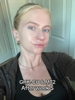Weeks 5–8 on my GHK-CU + MT2 peptide journey. Timing is everything. Re