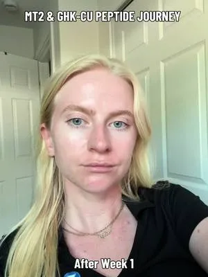 4 weeks of documenting my personal peptide journey. This post is for e